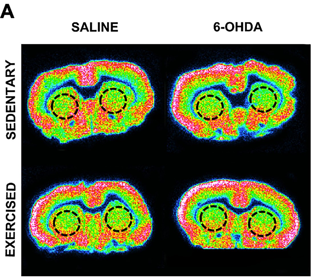 Fig. 4A: [3H]UCB-J autoradiograms of coronal rat brain sections at the striatum, saline or 6-OHDA, sedentary or exercised; dashed circles mark the striatum.