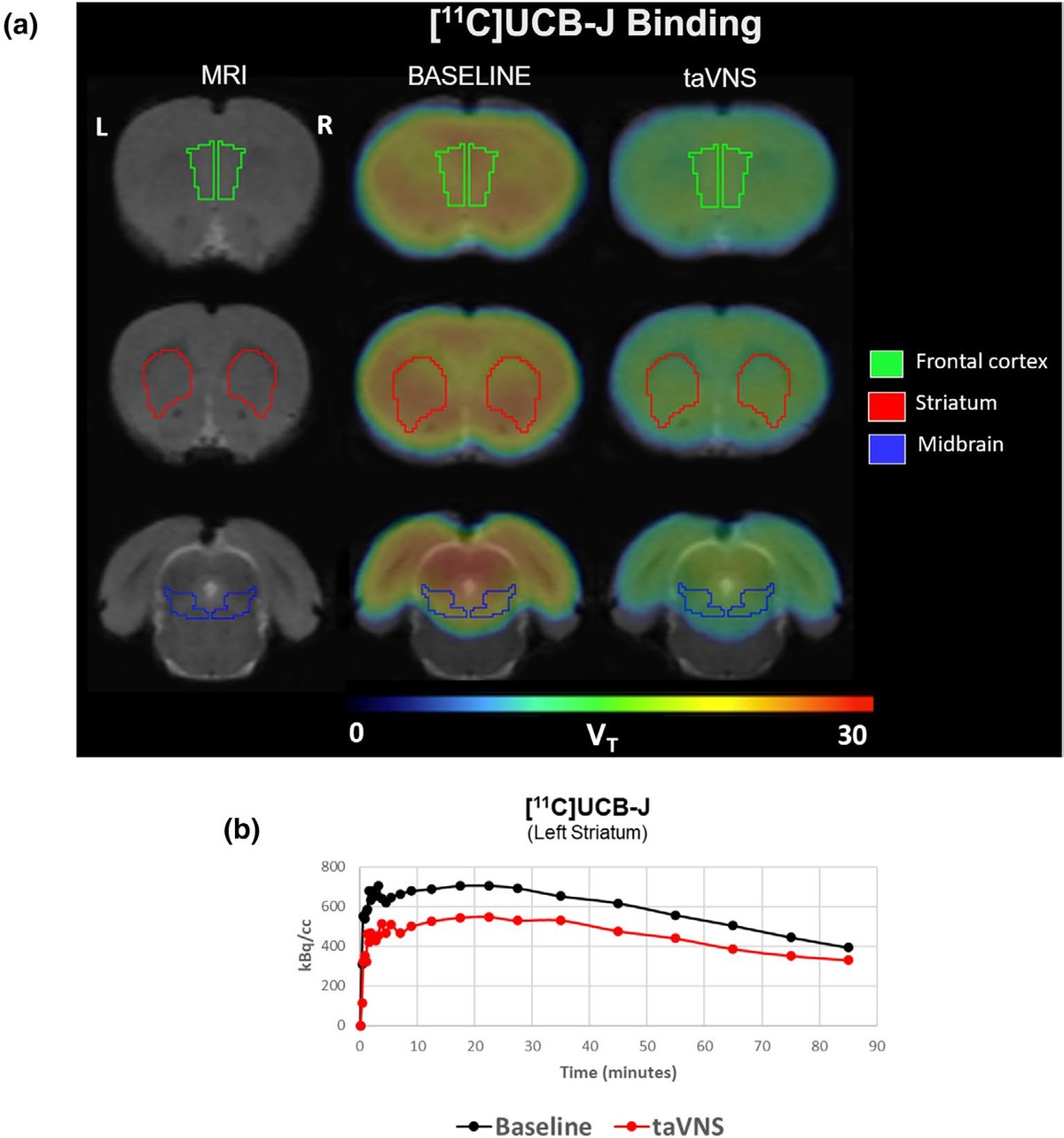 Published figure from Binda et al. 2025. Panel a: coronal rat brain slices; columns show MRI, [11C]UCB-J V_T maps at baseline, and V_T maps after taVNS, with frontal cortex, striatum and midbrain outlined; colour scale V_T 0 to 30. Panel b: time–activity curves in the left striatum over 90 minutes, baseline in black and after taVNS in red.
